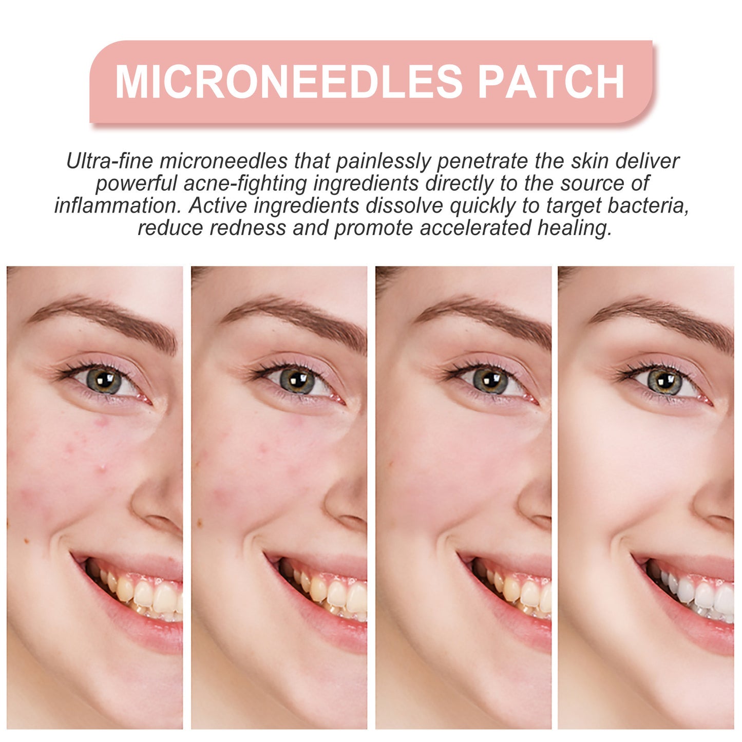 Patch Facial Redness Repair Acne Cleaning