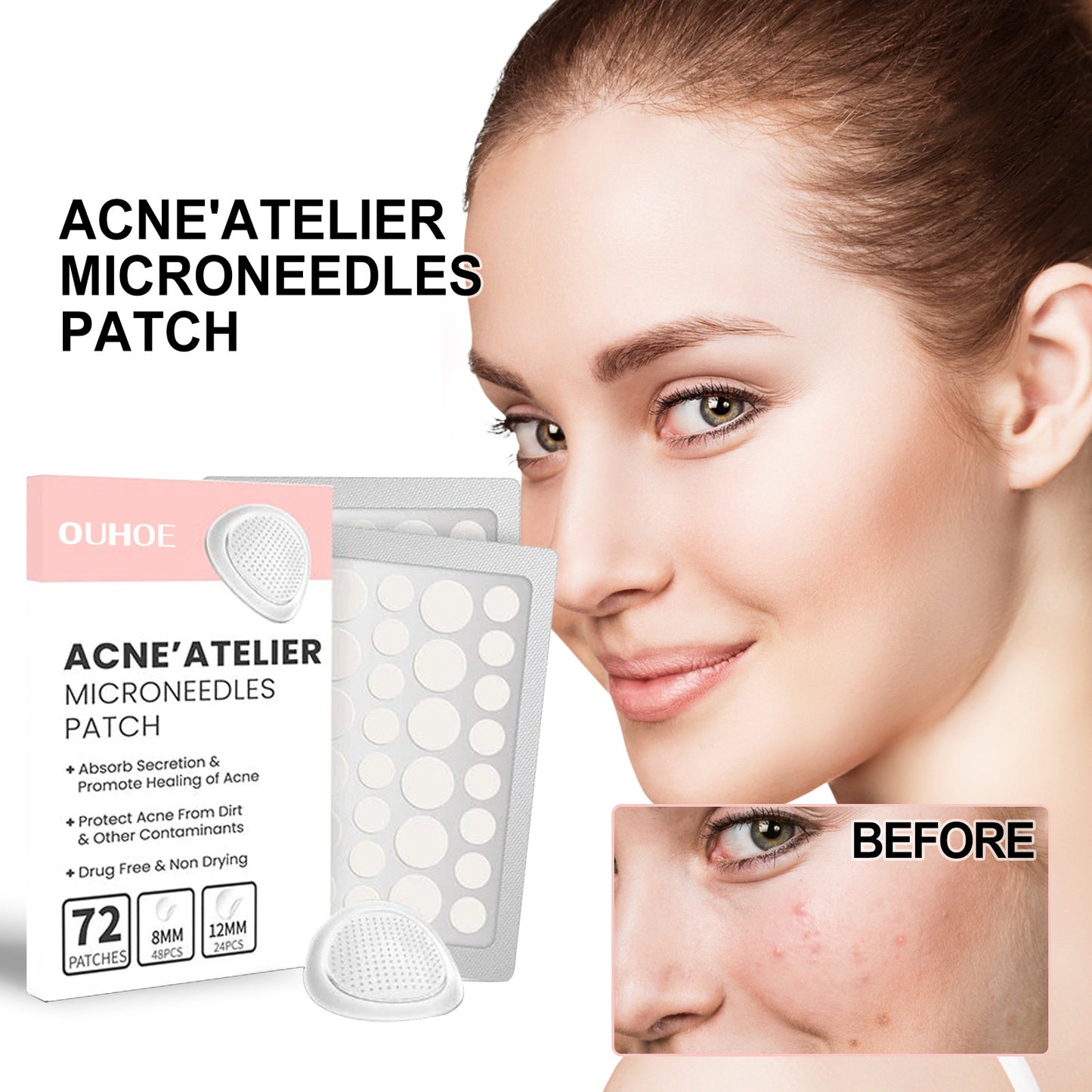 Patch Facial Redness Repair Acne Cleaning