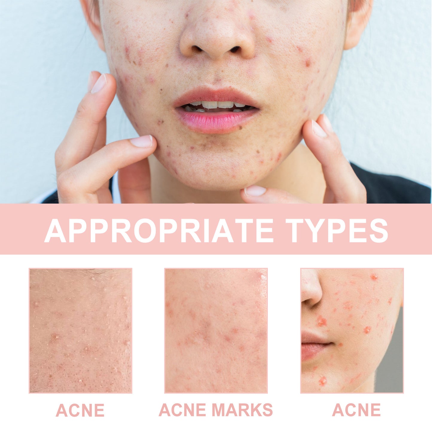 Patch Facial Redness Repair Acne Cleaning